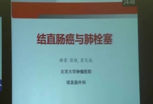 [CSMO2014]顾晋教授：结直肠癌与肺栓塞